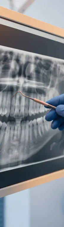 Dental X-ray being reviewed by a professional