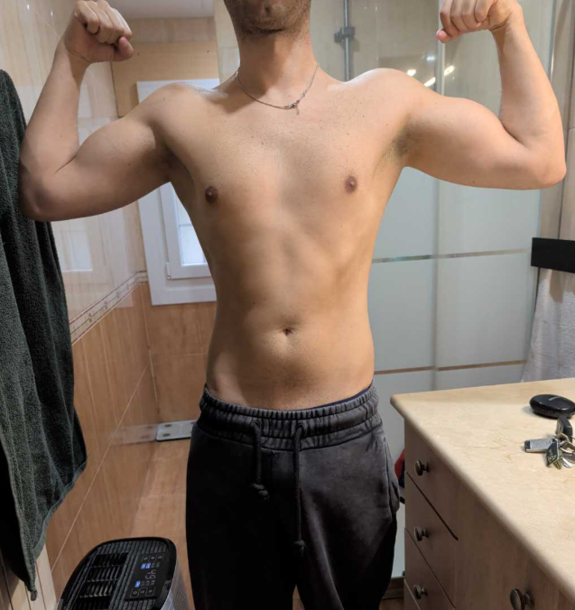 Brais Barreiro, foto de después
