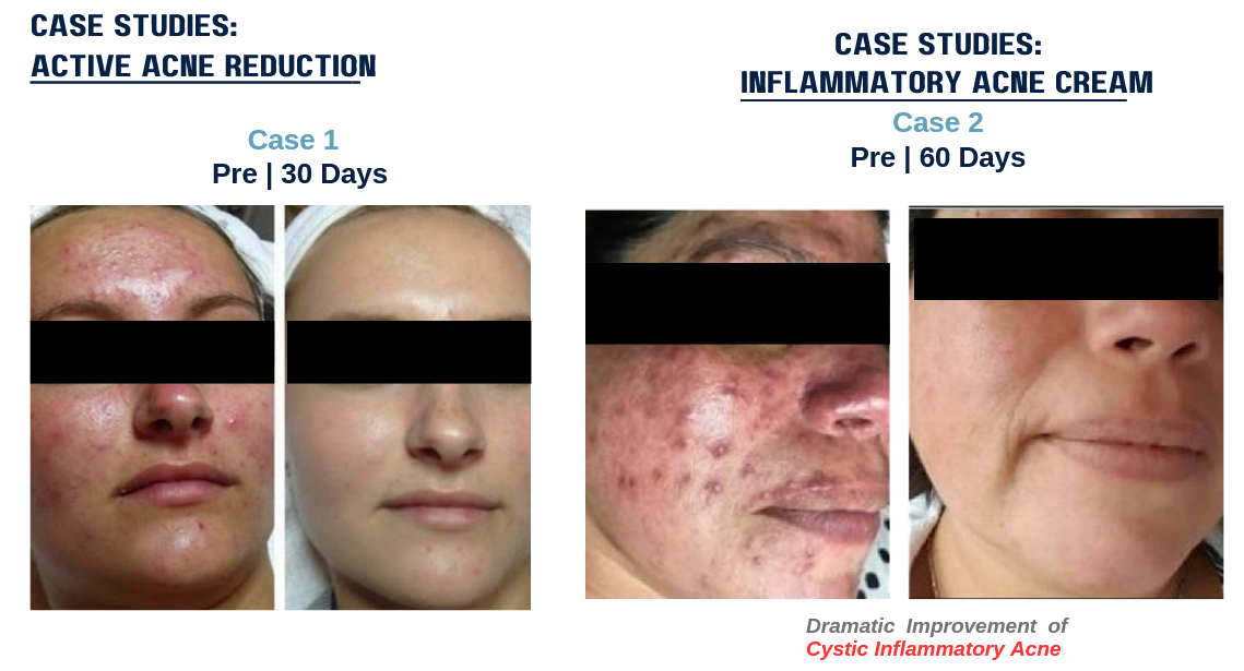 Pilot result: smoother-feeling skin