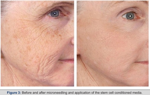 Pilot result: before and after
