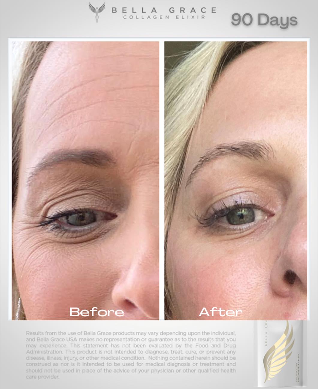 Best skincare product for eyelift wrinkles tighten