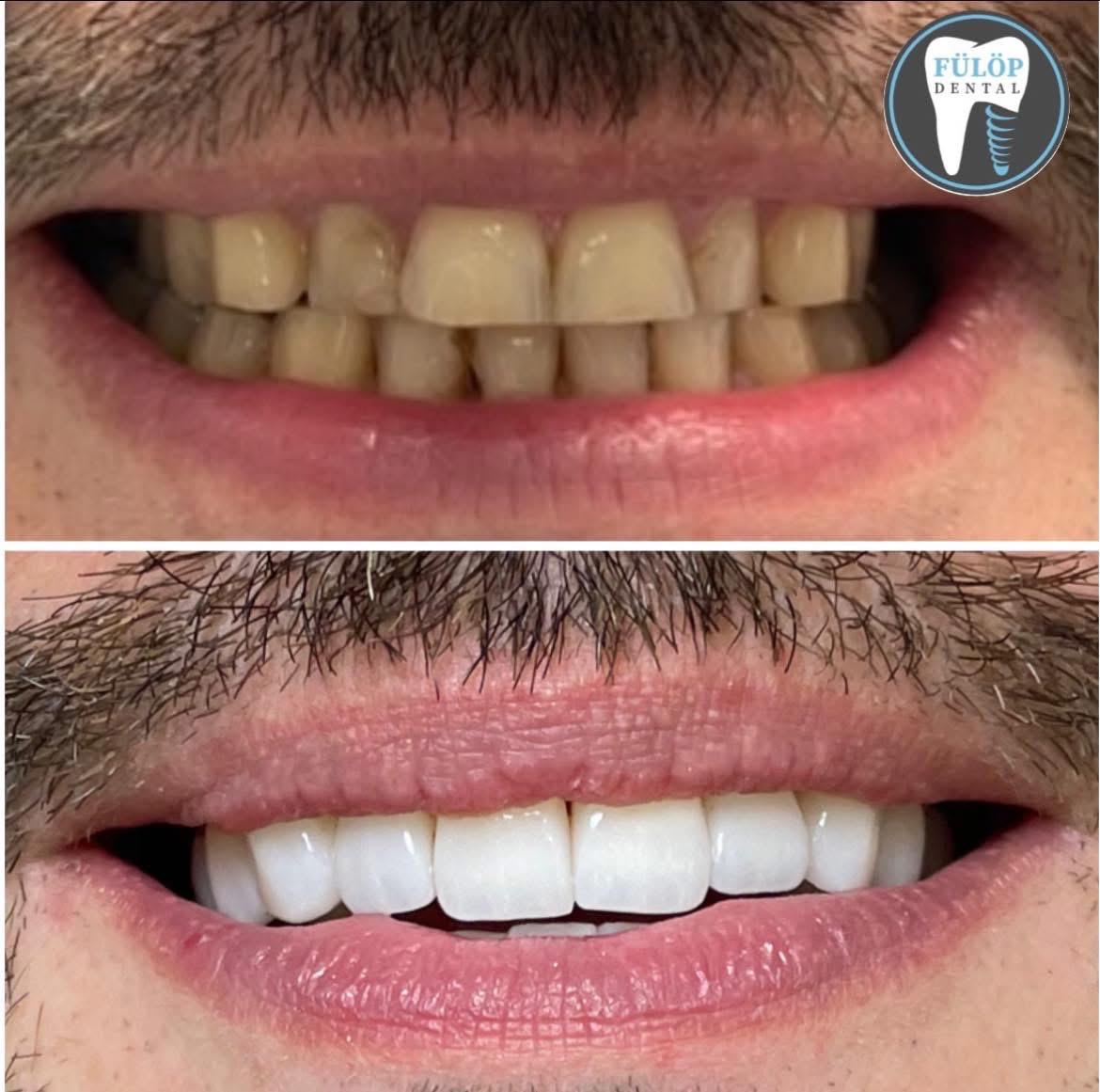 Fülöp Dentál munkánk 2