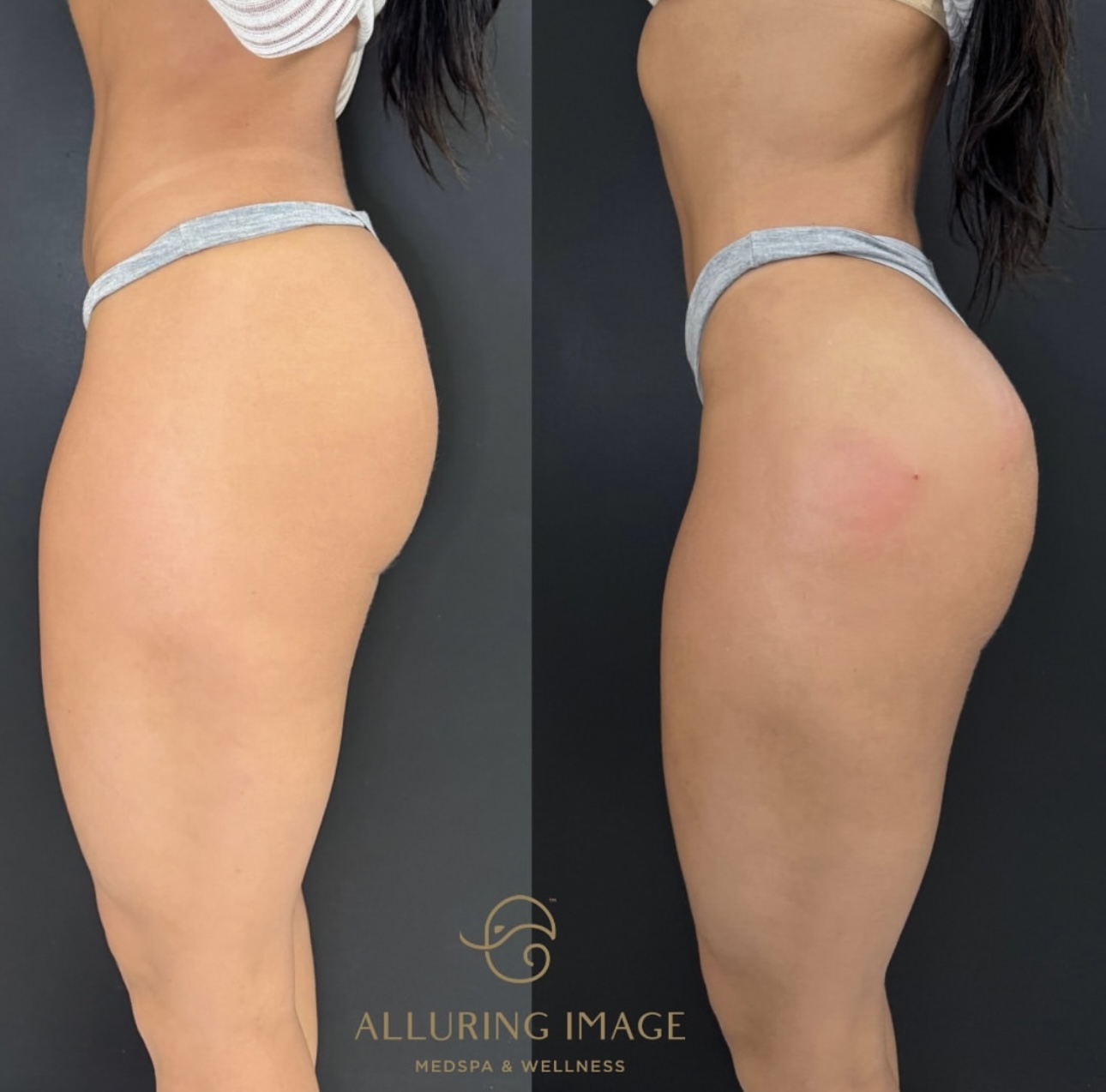 Before and After