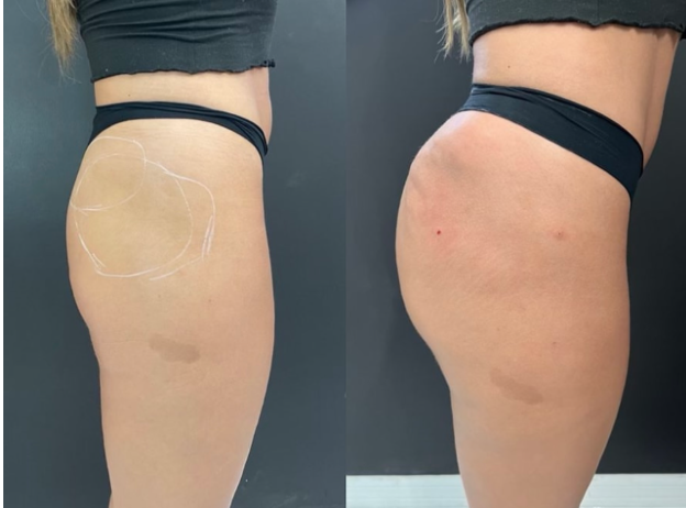 Before and After