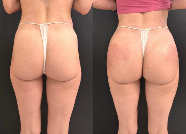 Before and After