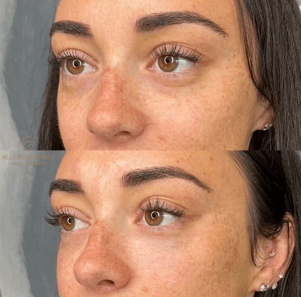 Before and After 2