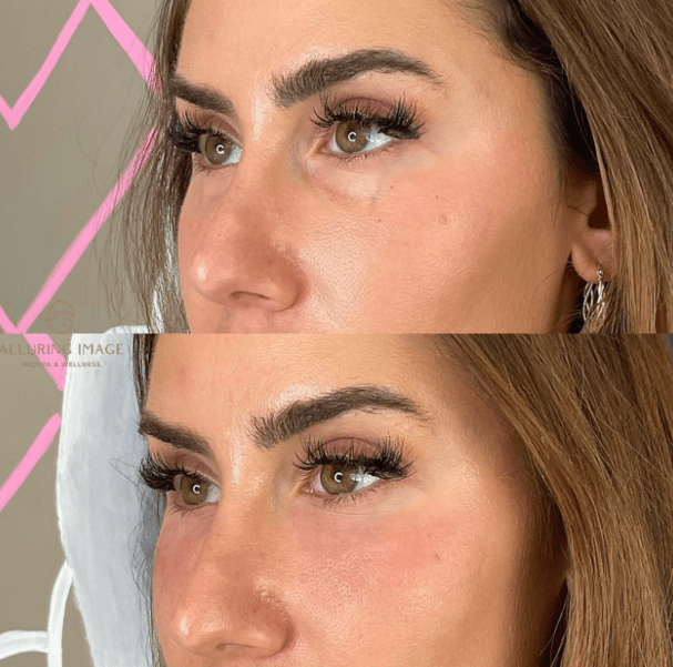 Before and After 3