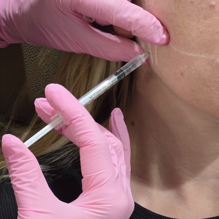 Botox Treatment