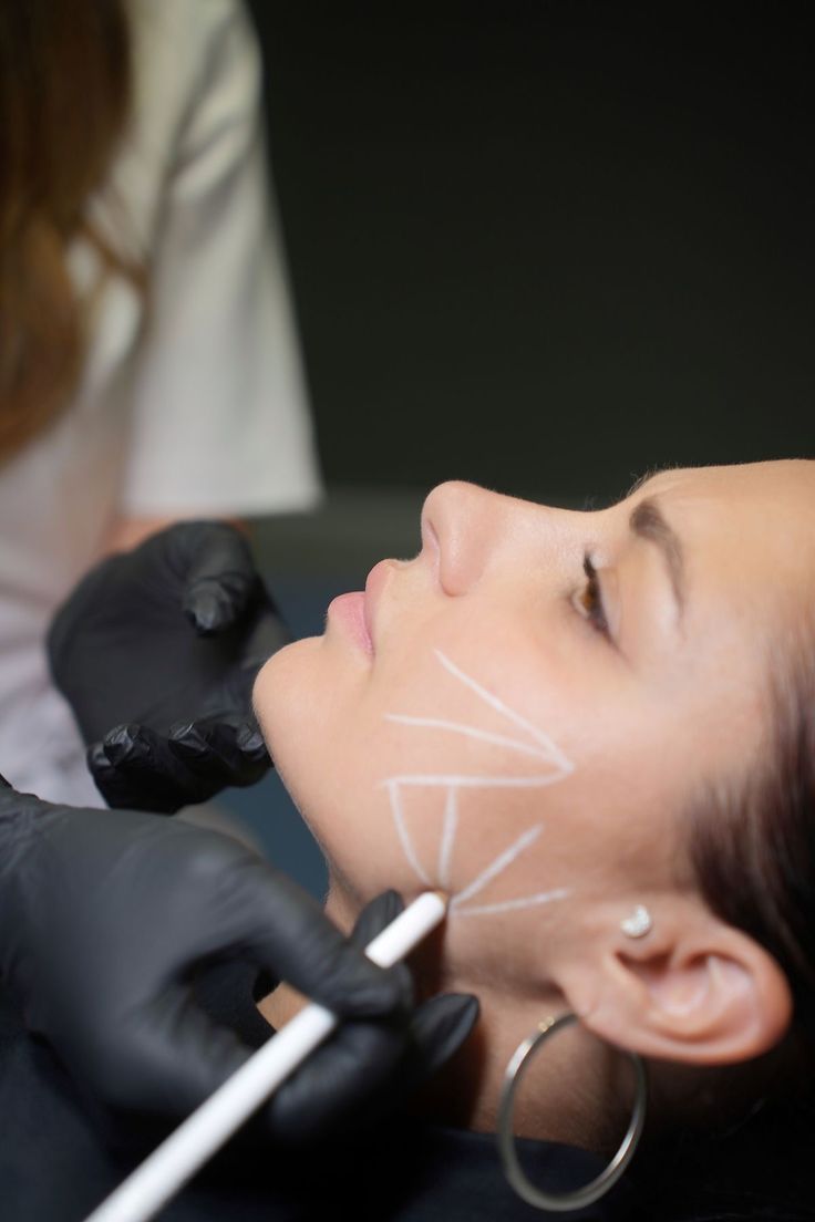 Botox vs Dysport: Differences