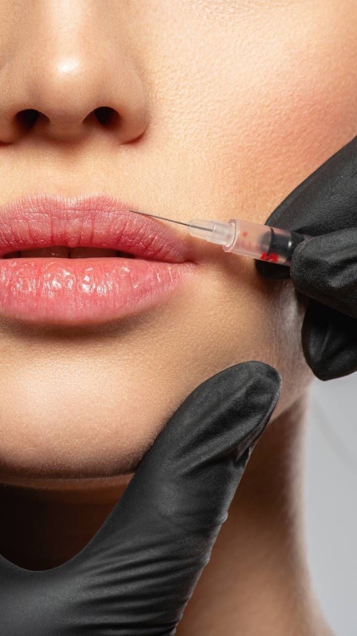 Facial Balancing in Delray Beach: Why Your Injector's Approach Matters More Than the Product