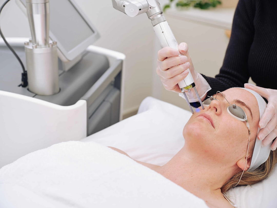 Pico Genesis treatment at Clinica Lase