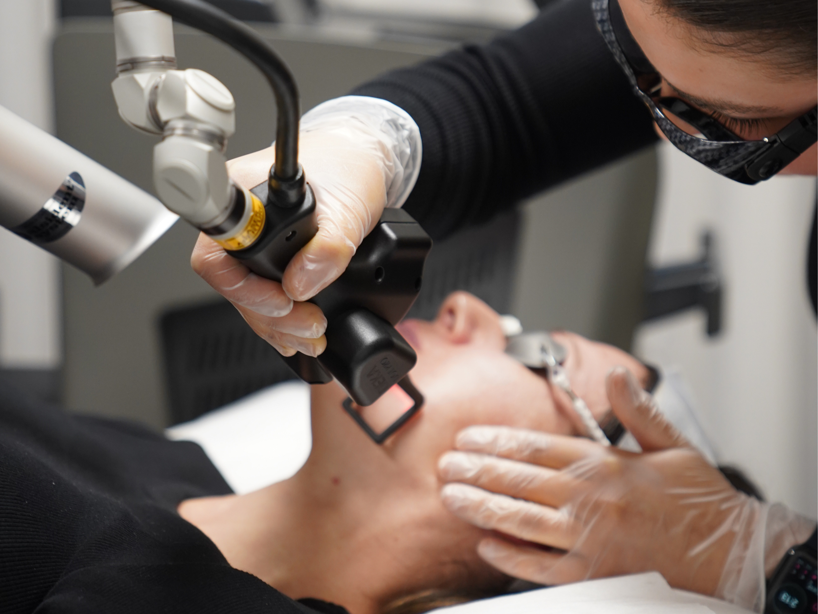 CoolPeel treatment at Clinica Lase