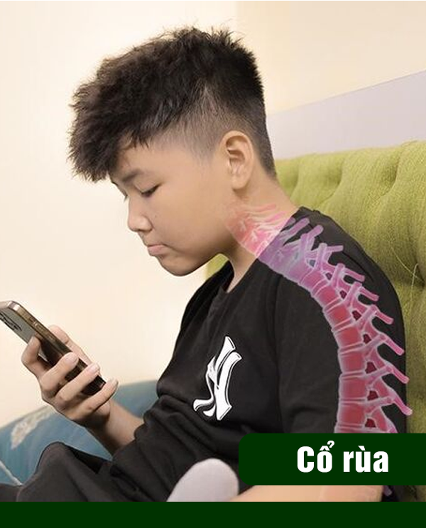 Cổ rùa