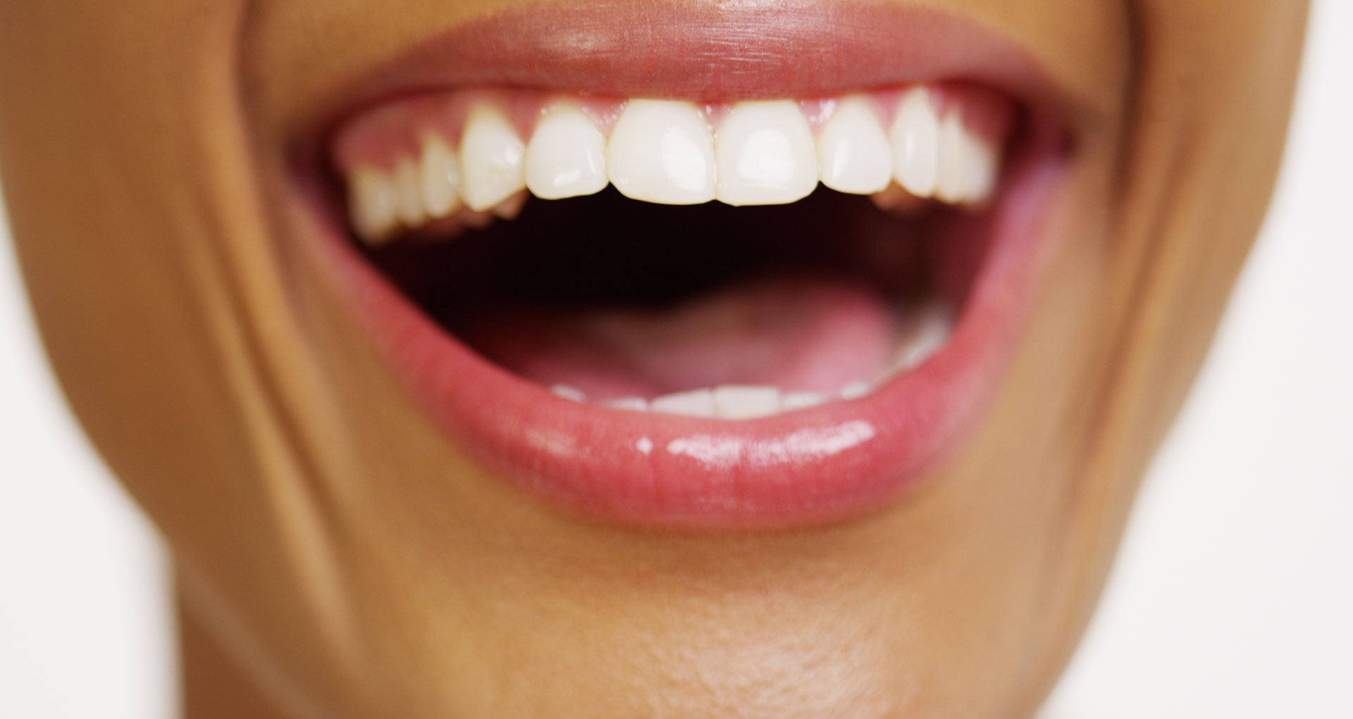 Woman with teeth whitening
