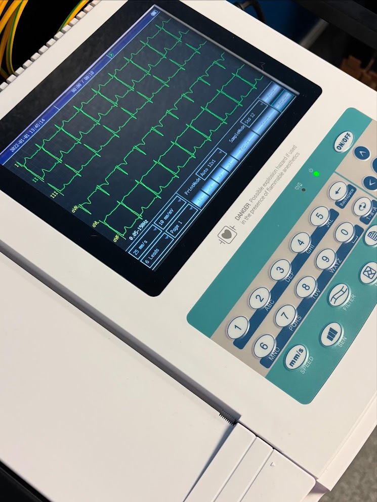 EKG Machine Reading and Monitor Display