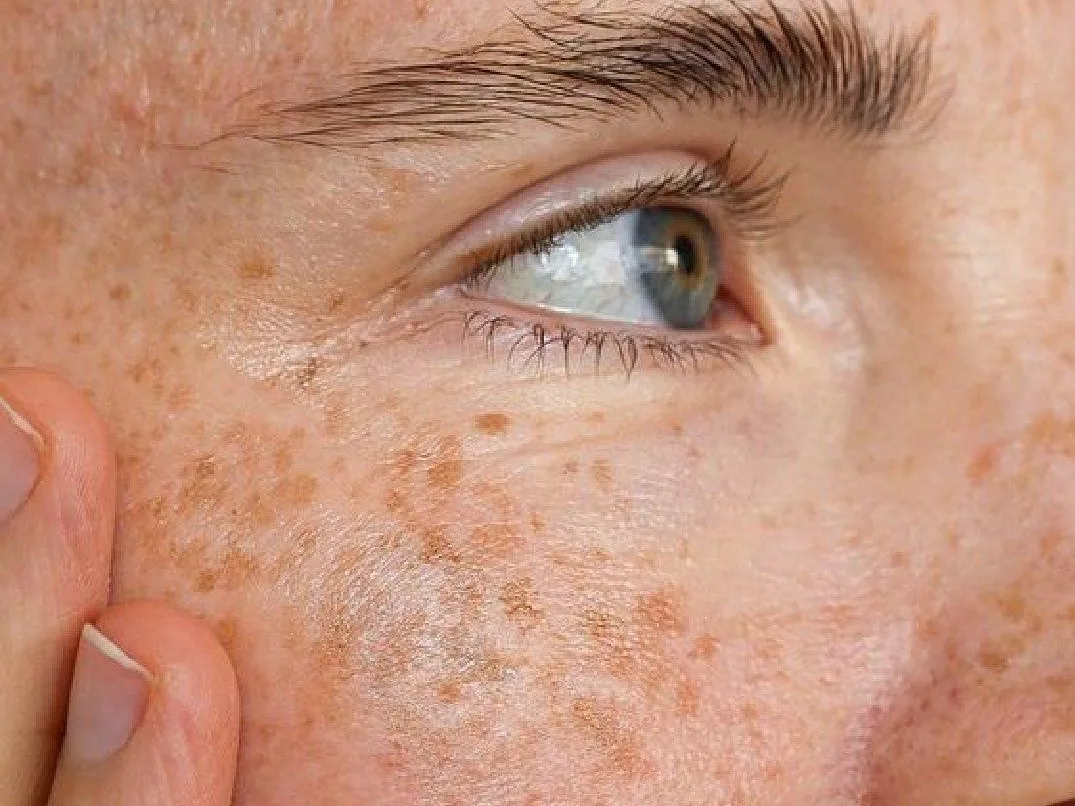 Pecas