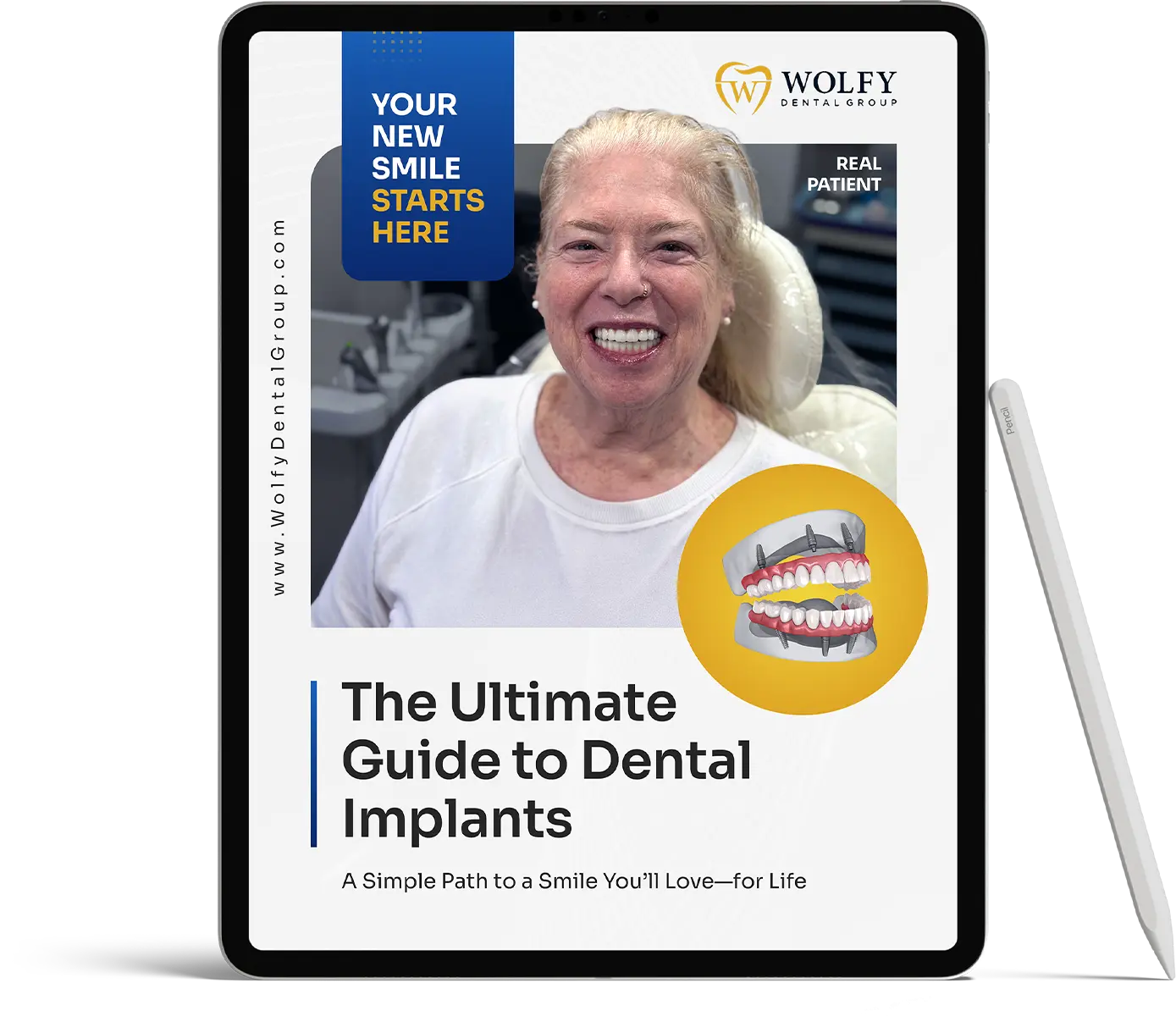 The Ultimate Guide to Dental Implants
