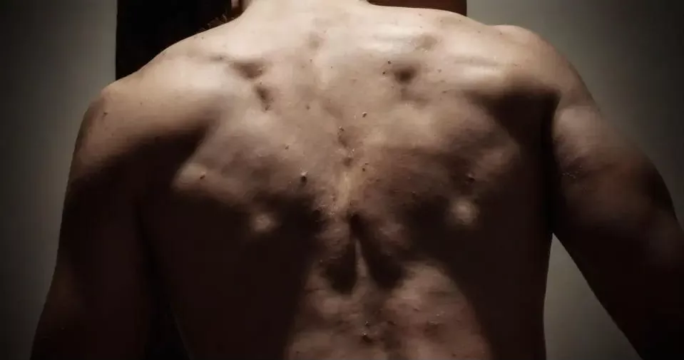 backpicture
