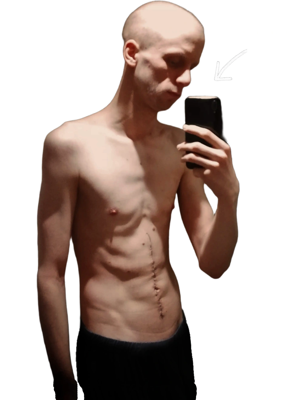 before transformation