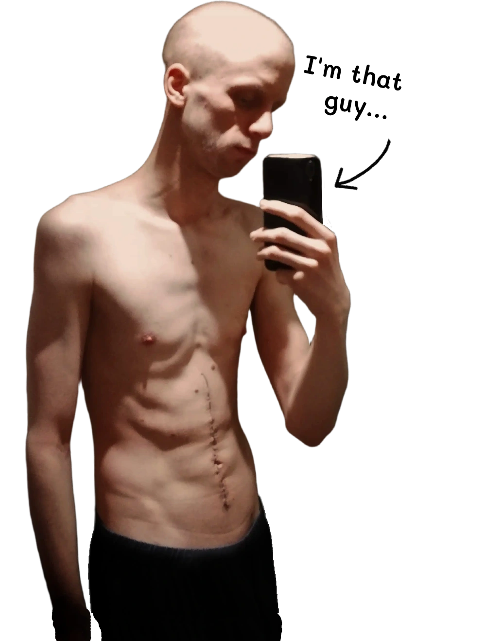 before transformation