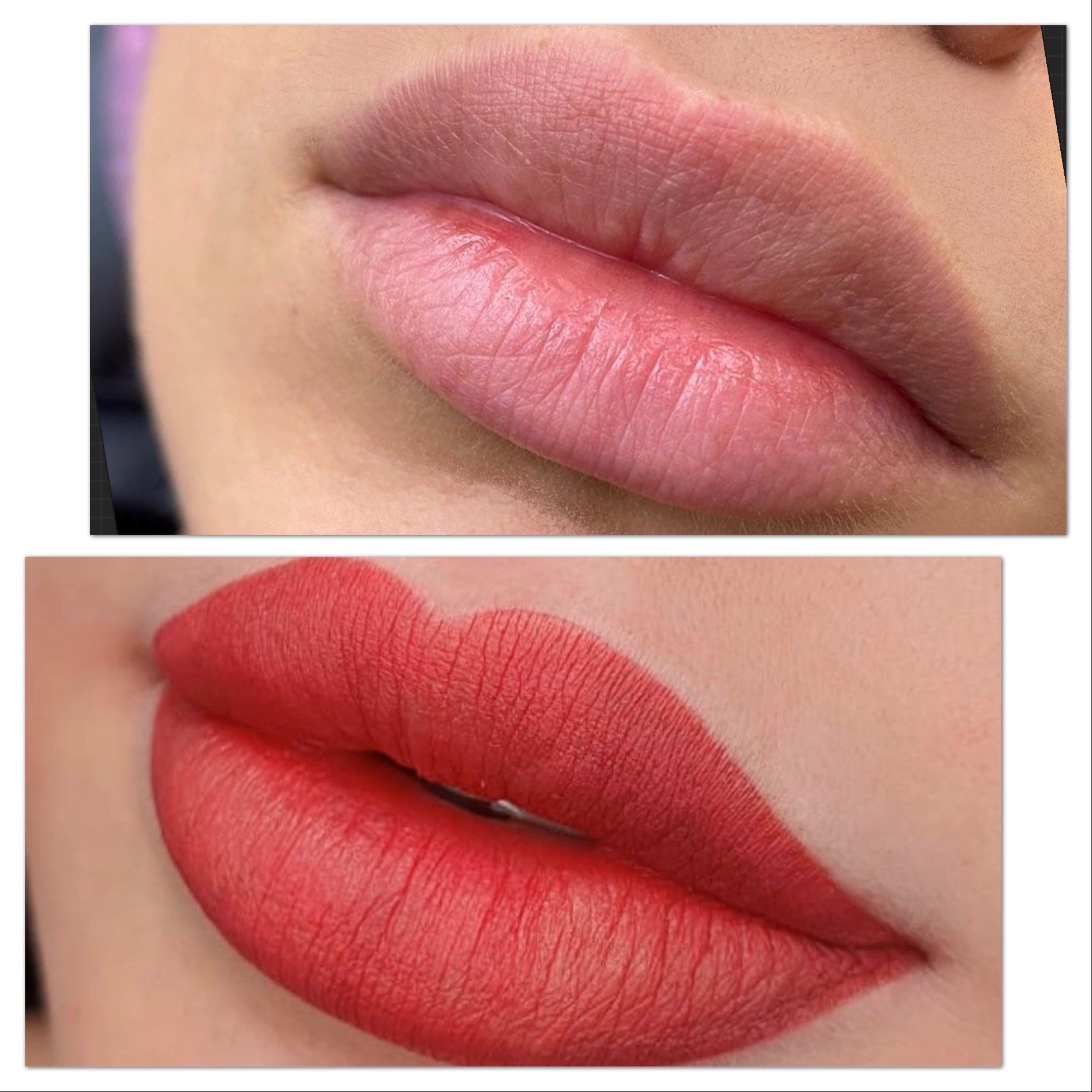 Close-up of lip blush procedure