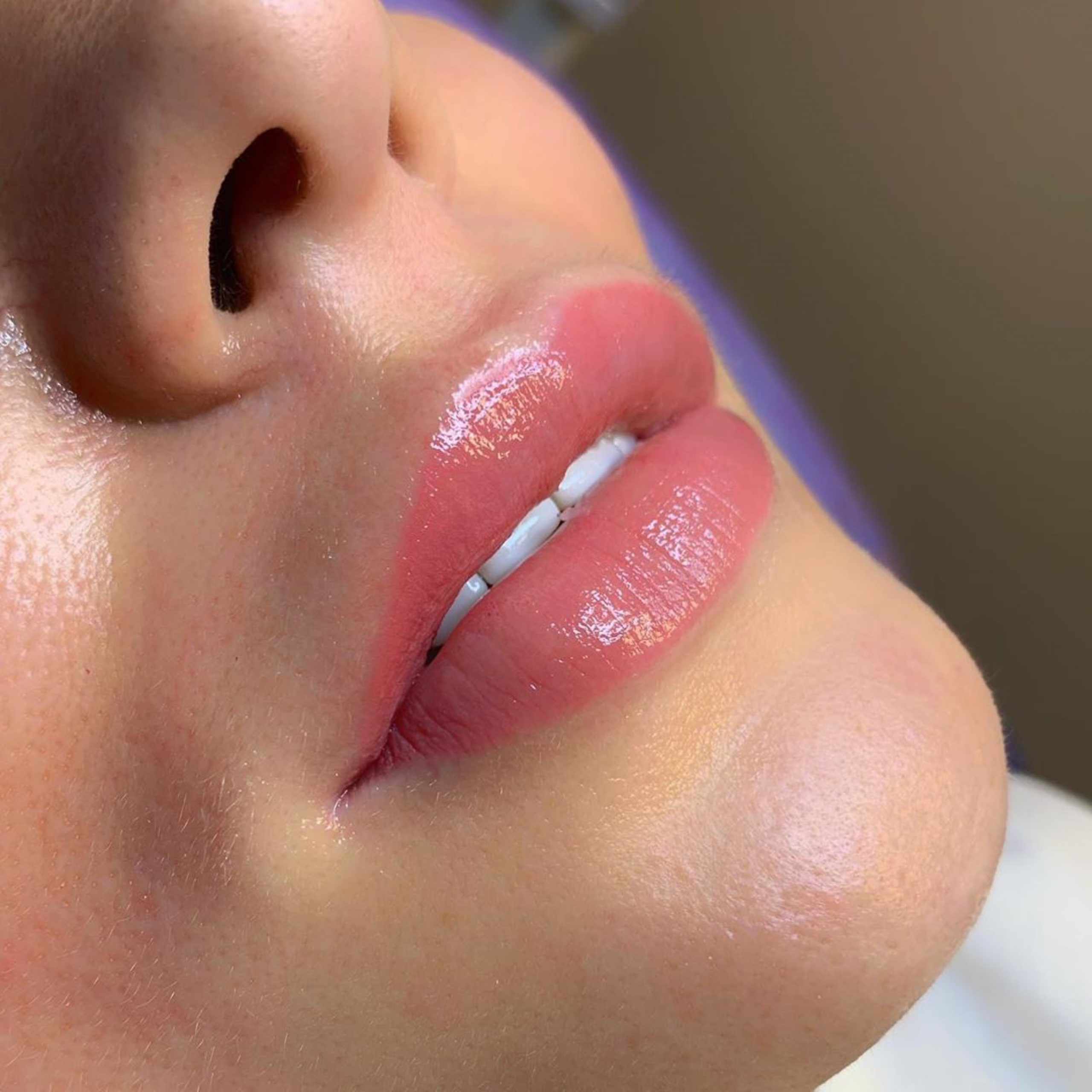 Lip blush result