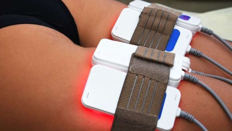 Laser lipo treatment moment