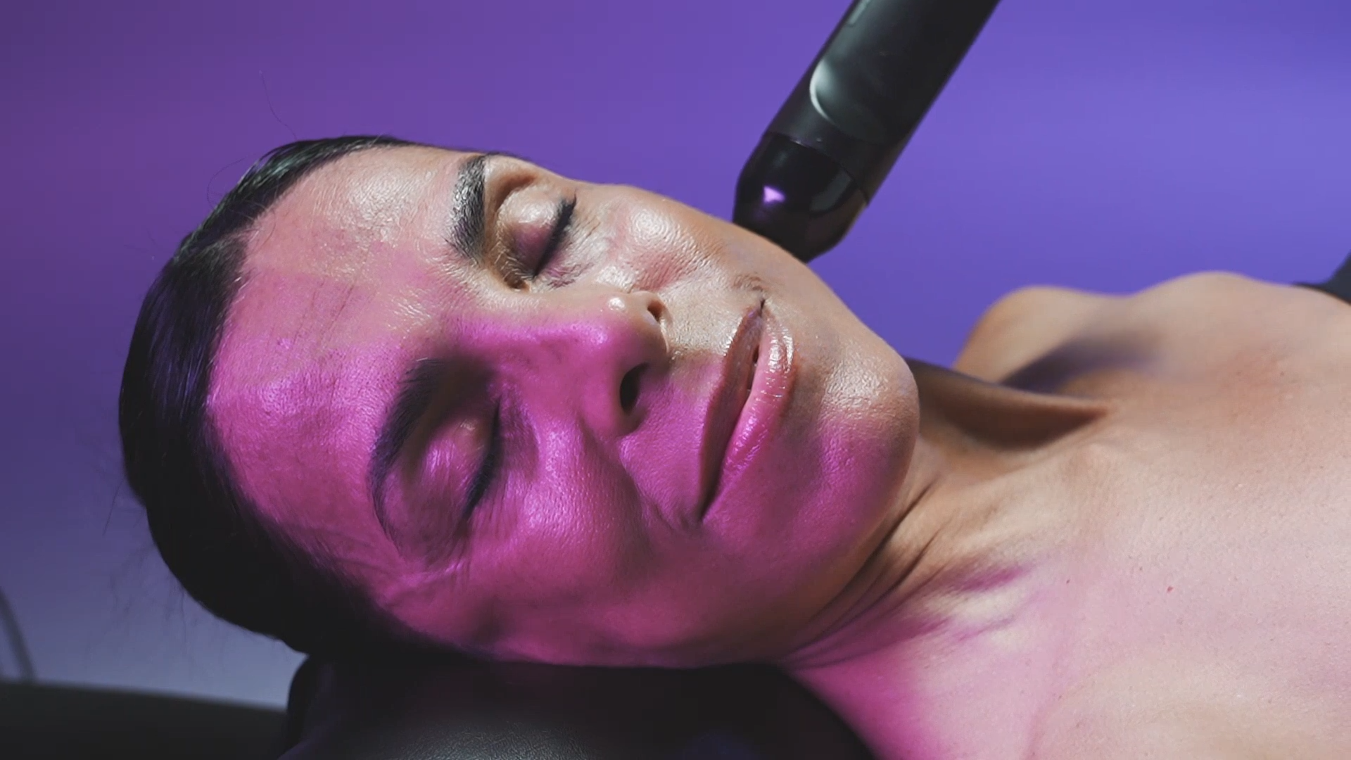 Skin before Glo2 facial