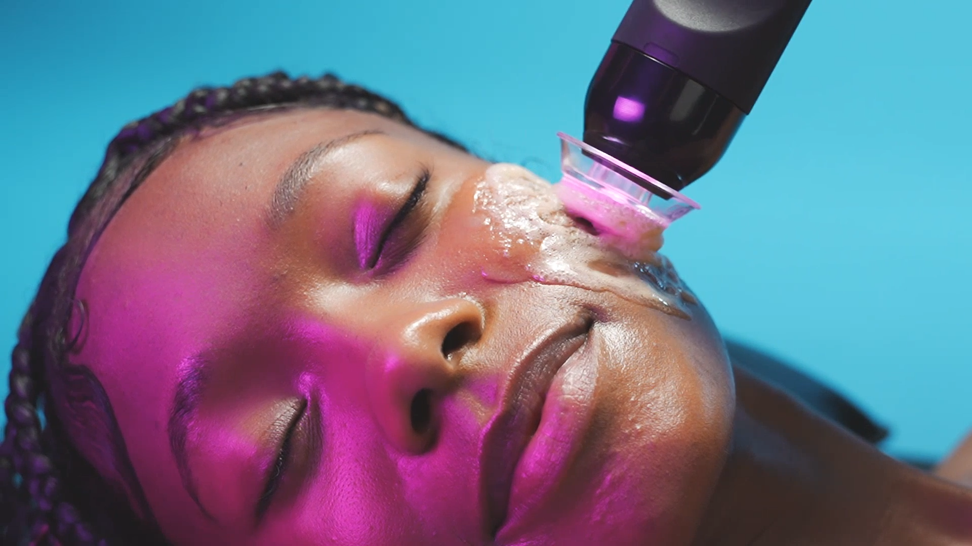 Skin after Glo2 facial