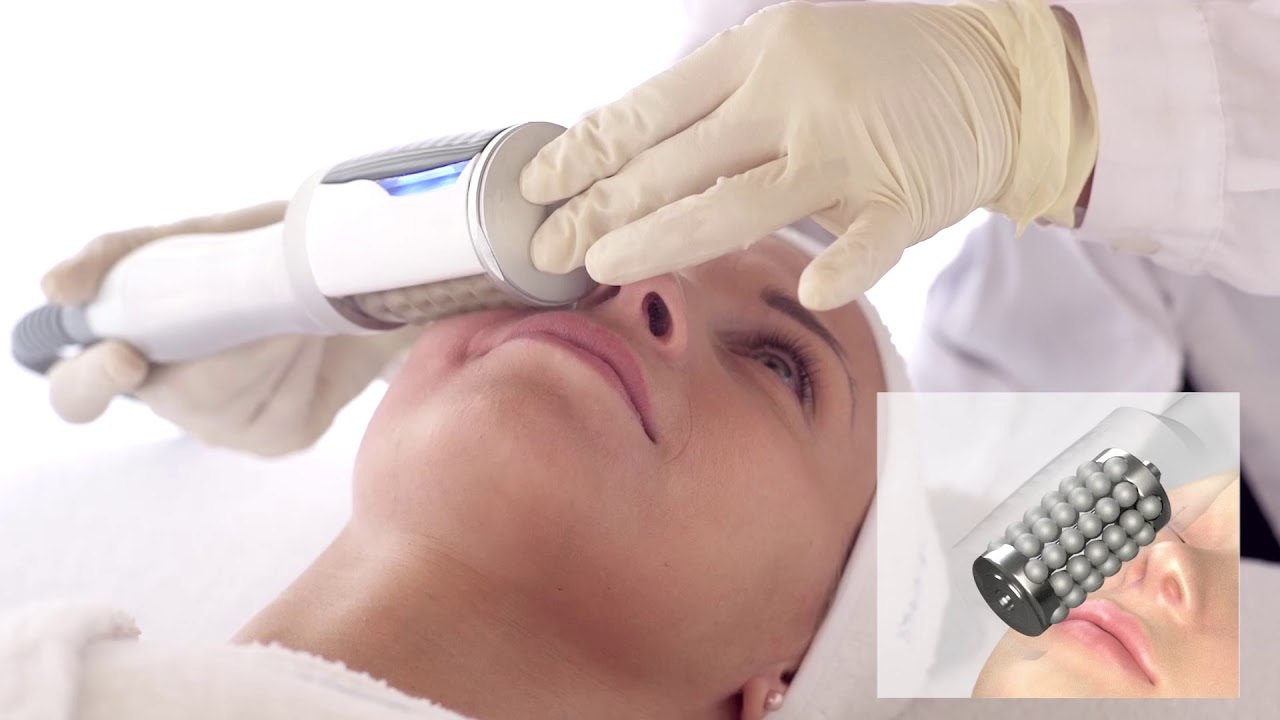 Endosphere facial close-up at Nu Way Beauty