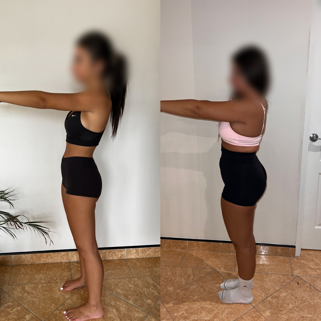 Anna — Before & After