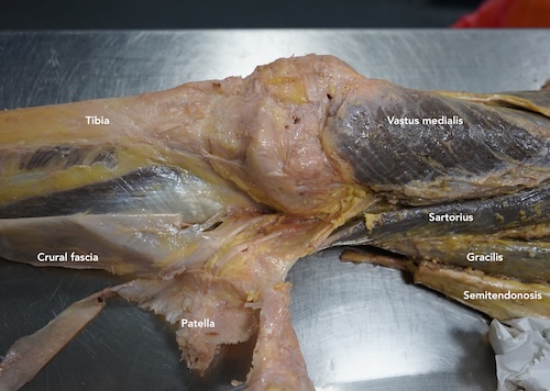 Pes anserinus dissection of right knee