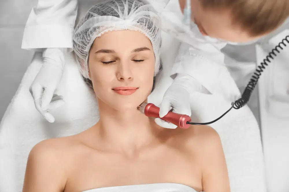 RF microneedling treatment combining radiofrequency with microneedling in Saint Clair Shores
