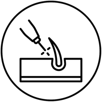 Laser hair removal treatment being performed on smooth skin