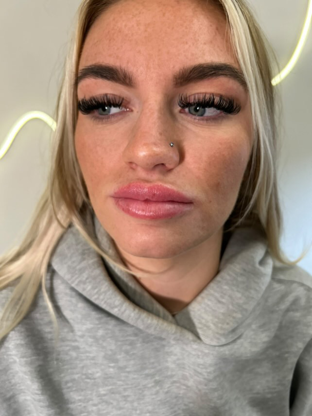 Before lip blush treatment by XXII Ink