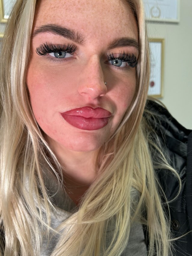 After lip blush treatment by XXII Ink