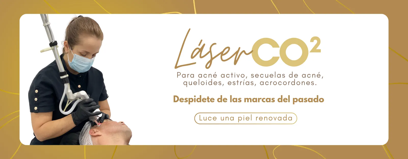 Láser CO2: para acné activo, secuelas de acné, queloides, estrías y acrocordones