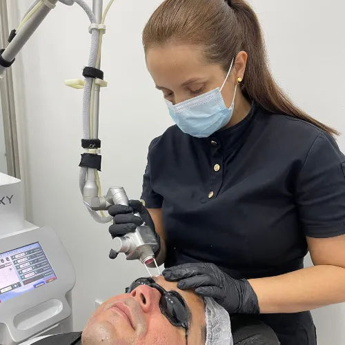 Láser CO2 Facial