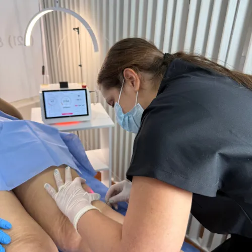 Endolifting Corporal