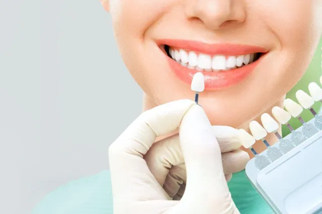 Carillas Dental Cairo