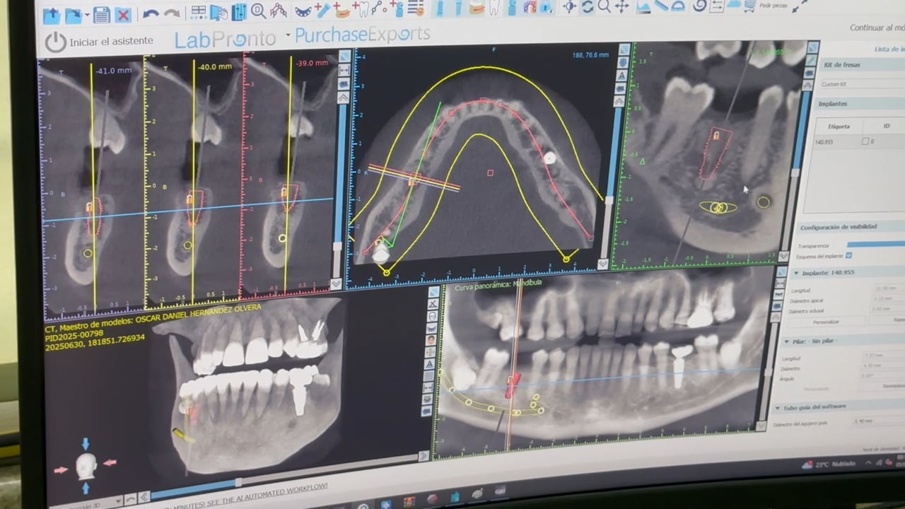 Monitor con placas dentales