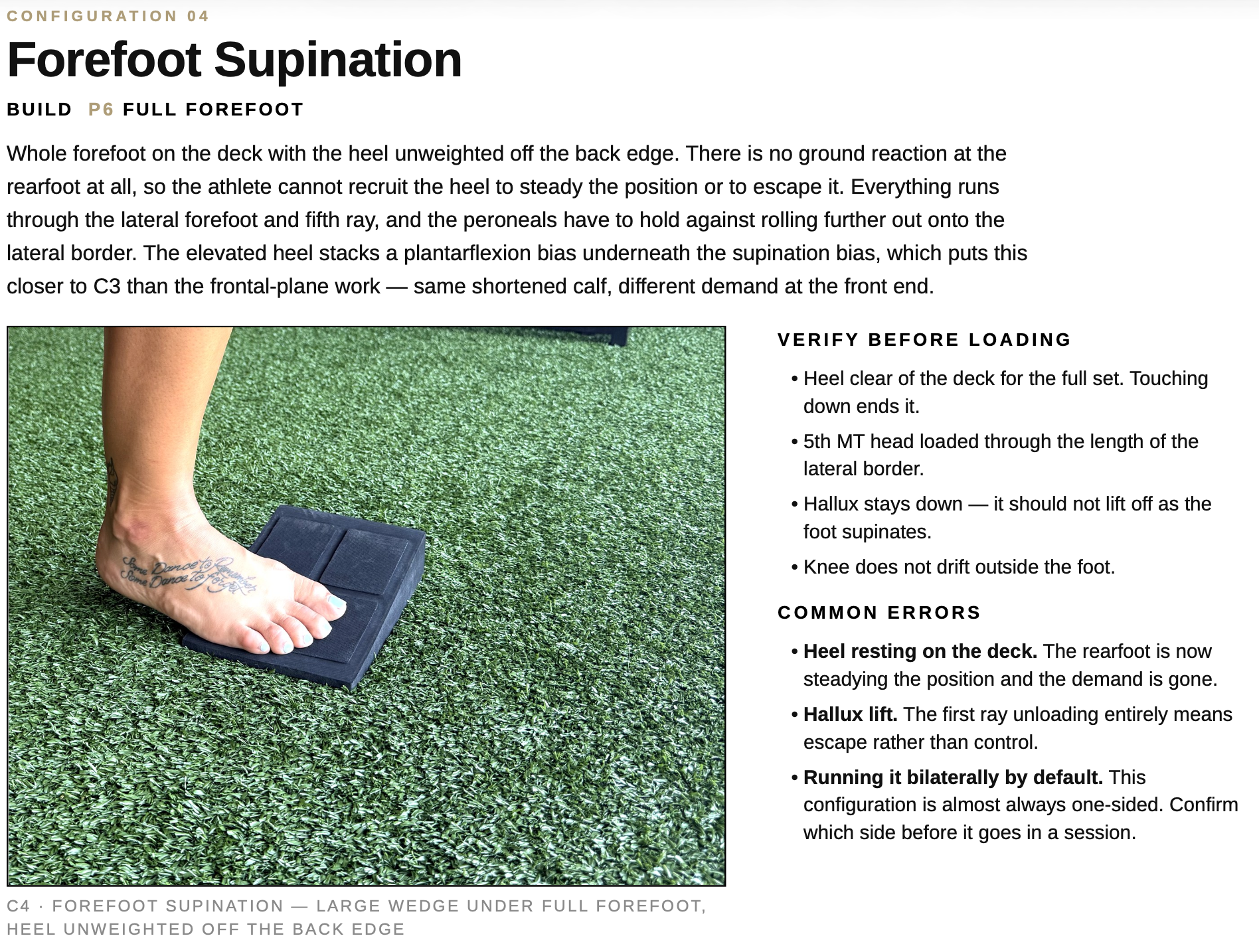 Forefoot Supination Overview Forefoot Supination Overview