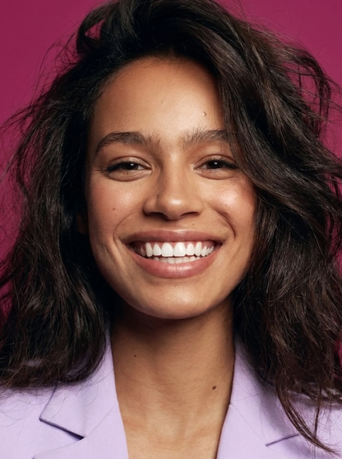 Composite bonding after result - Sale Dental Spa