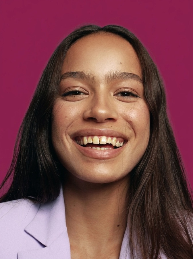 Composite bonding before treatment - Sale Dental Spa