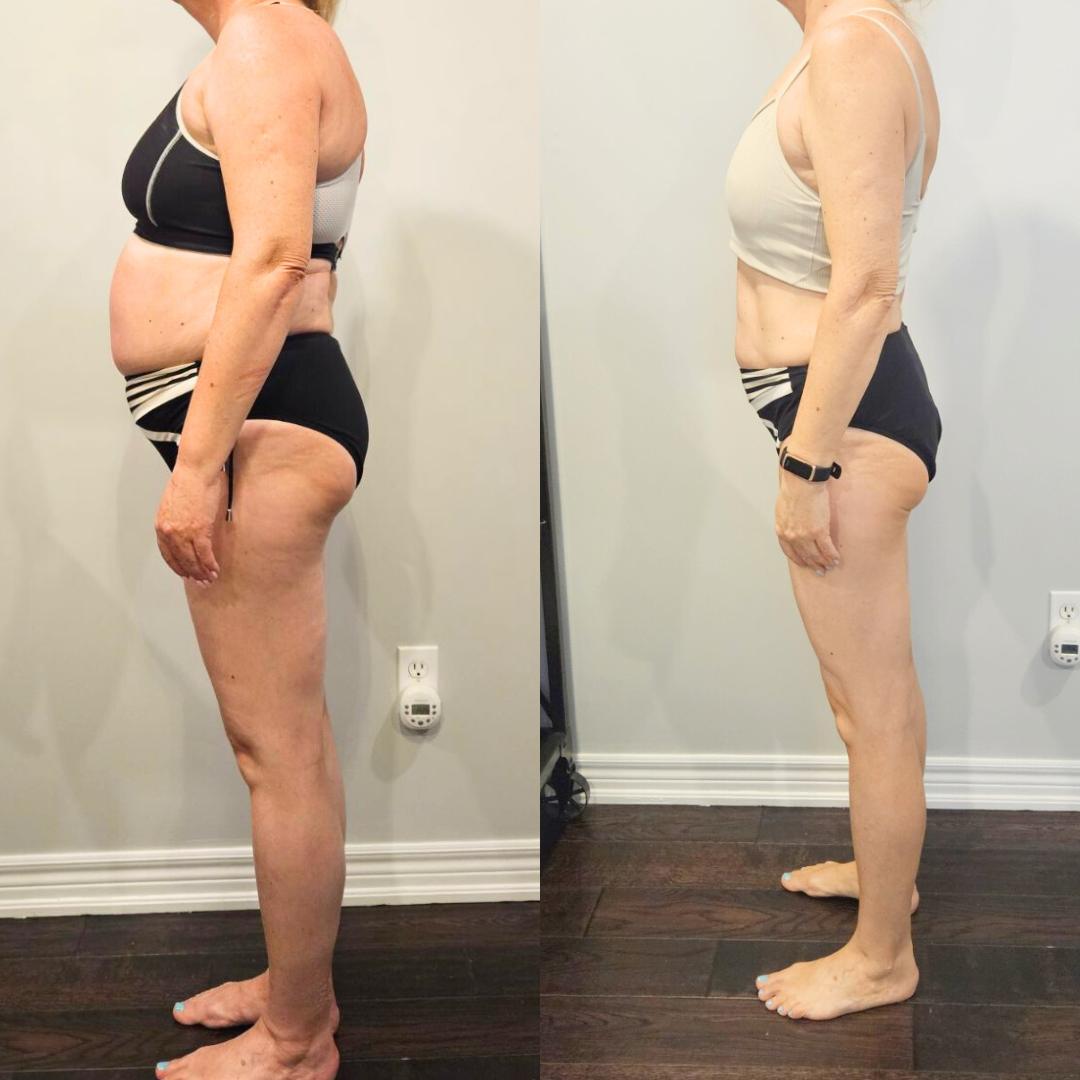 Client before and after