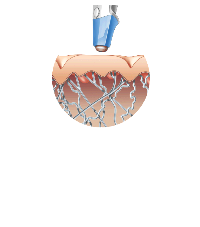 Exilis Animation