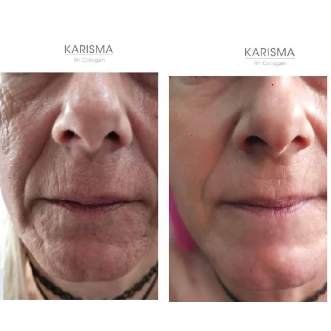 Karisma Box