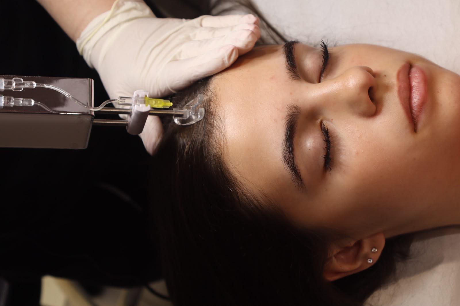 Meso Gun Treatment