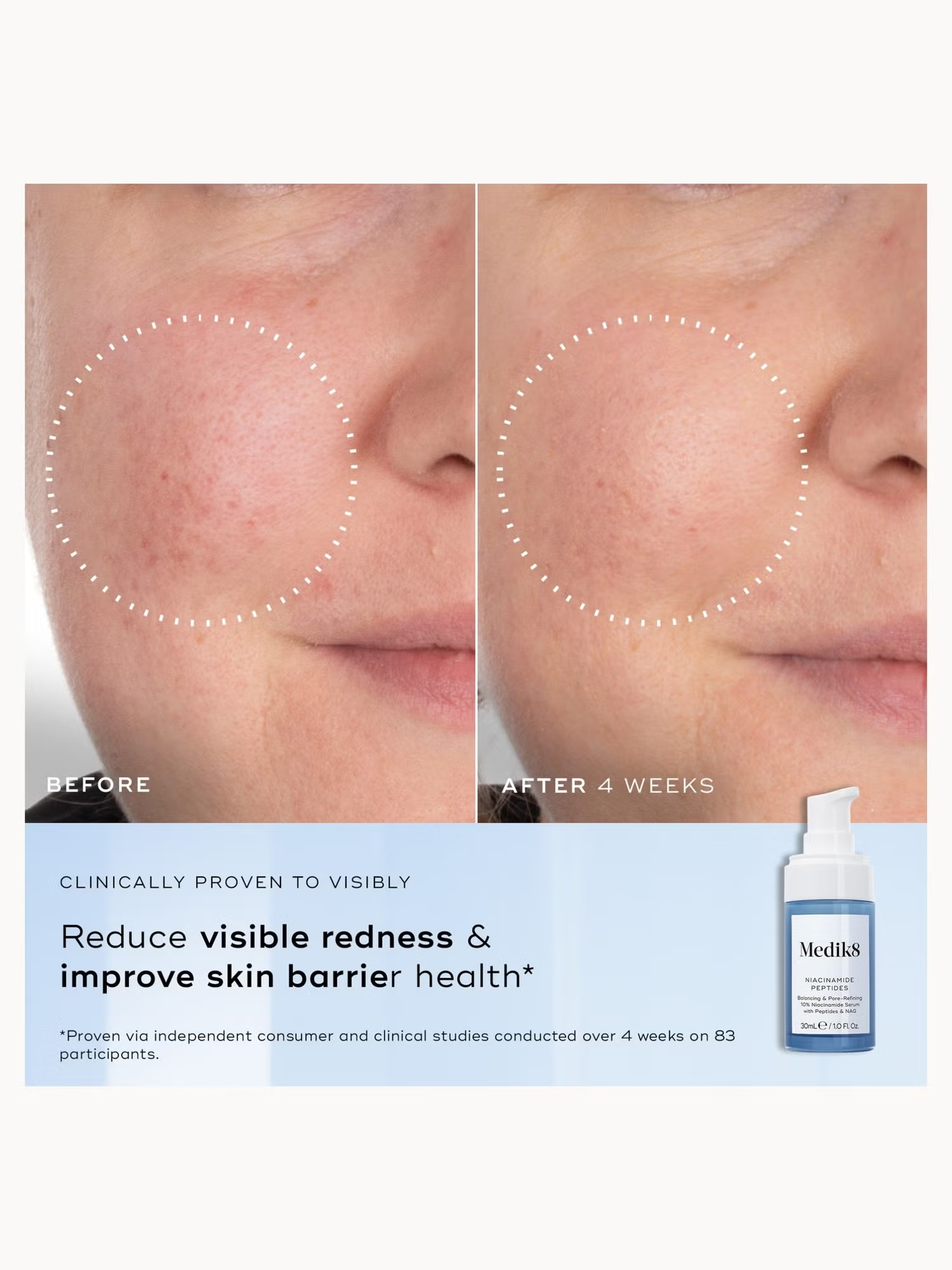 Medik8 Niacinamide Peptides serum results and glow