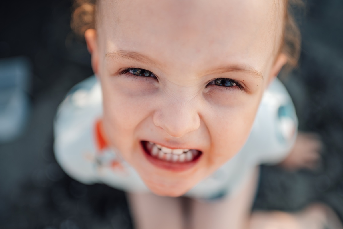 Can a Child Have Tooth Decay Even If Their Teeth Look Healthy?